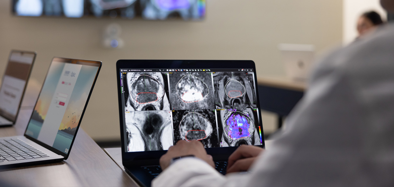 En person gennemgår medicinske scanninger på en MacBook. To andre MacBook-enheder står åbne i baggrunden.