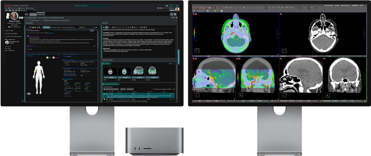 Radiology workstation with dual monitors showing brain imaging studies, including patient data, 3D models, and multi-planar MRI and CT scans.